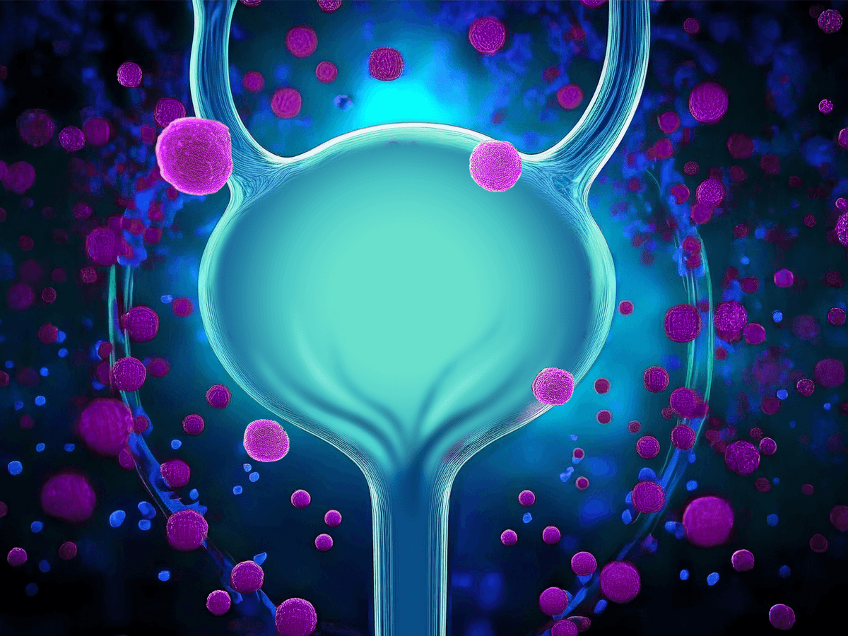 Raising the bar in bladder​ cancer care: Collaborative​ approaches to treatment​ selection, application and​ integration